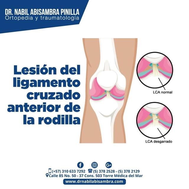 Lesión de ligamento cruzado anterior de la rodilla