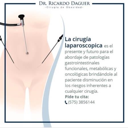 Cirugía bariátrica por laparoscopia