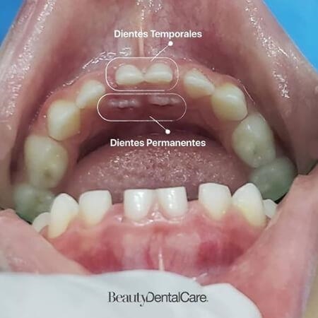 Odontología pediátrica
