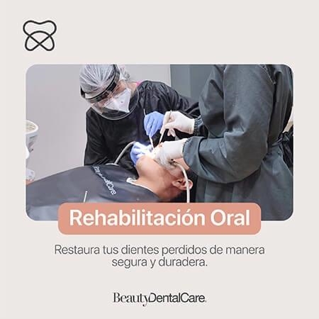 Rehabilitación oral