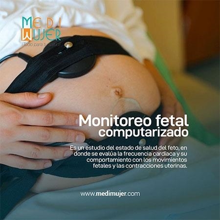Monitoreo fetal computarizado