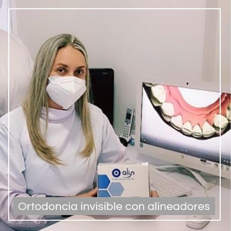 Invisible orthodontics with aligners