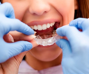 Orthodontic treatment in Barranquilla