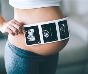 Everything you need to know about the fetal echocardiogram by Dr. Yolima Martínez in Sogamoso