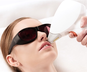 Diode laser for permanent hair removal by Vivante in Barranquilla