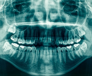 Panoramic dental X-ray in Barranquilla
