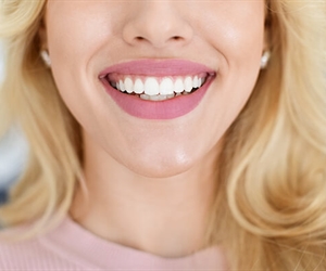 Dental crowns by Beauty Dental Care