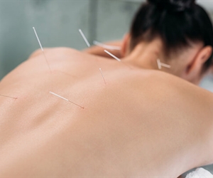 La acupuntura china para el alivio del dolor en Cali