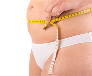 Liposuction in Colombia - Frequently Asked Questions and Prices
