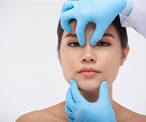Rhinoplasty in Colombia - Prices and everything you need to know