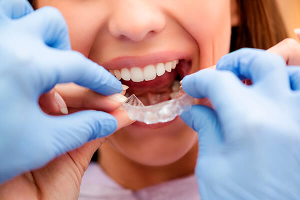 Tratamiento de ortodoncia en Barranquilla