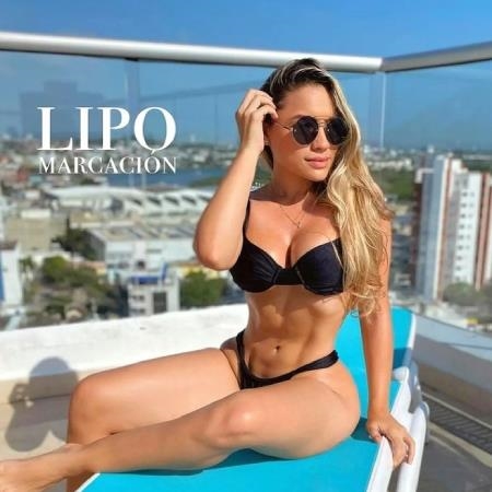 Liposuction - Lipo