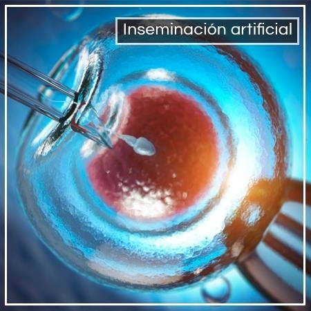 Artificial insemination 