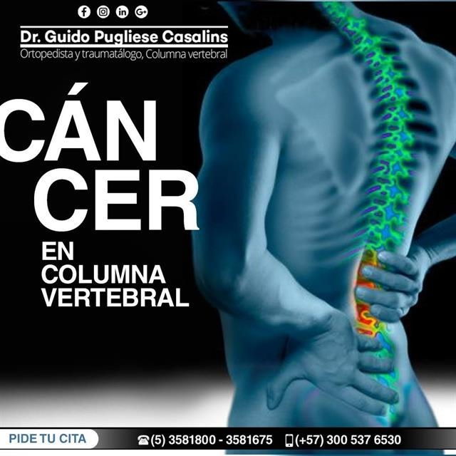 Spine cancer