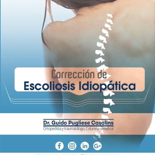 Ideopathic scoliosis