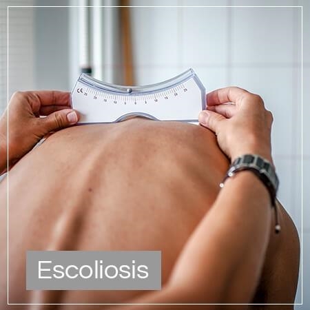 Escoliosis 