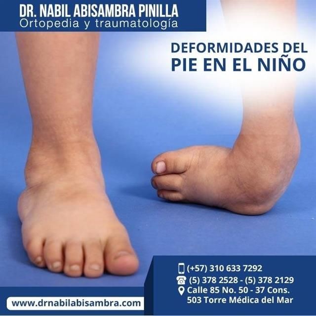 Pediatric Foot Deformities