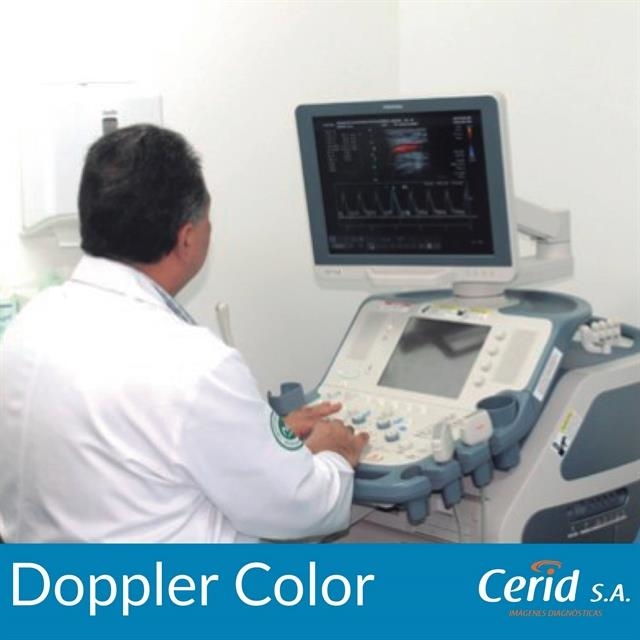 Color doppler ultrasound