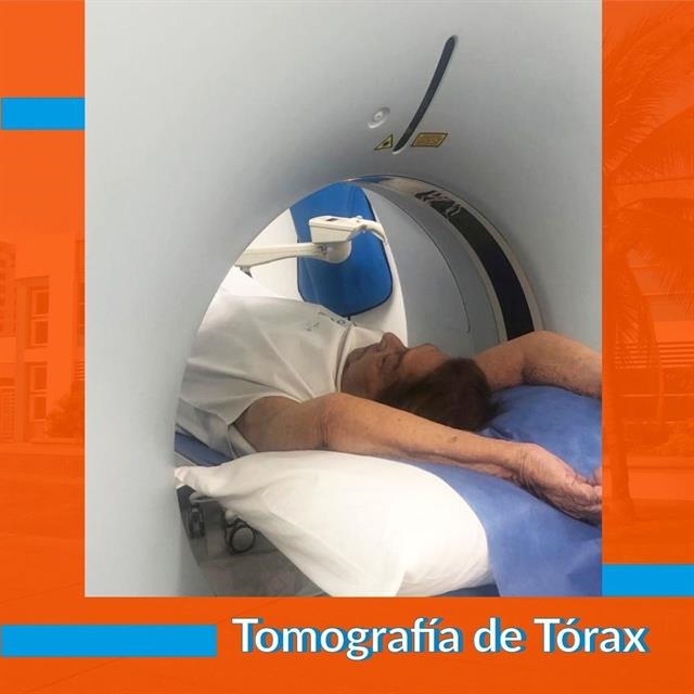 Tomografía de tórax