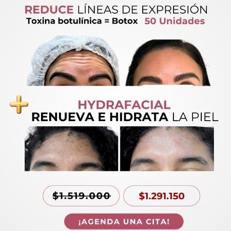 ¡Botox + Hydrafacial en PROMO! 