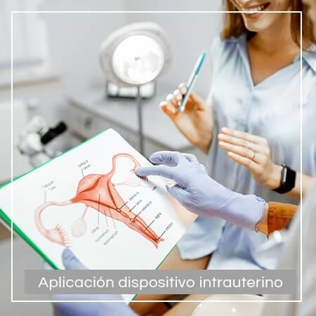 Intrauterine device application