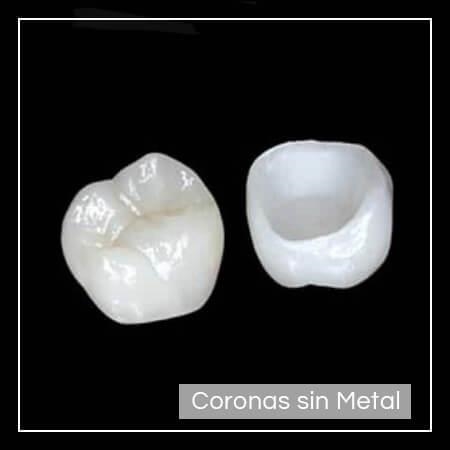 Coronas sin metal