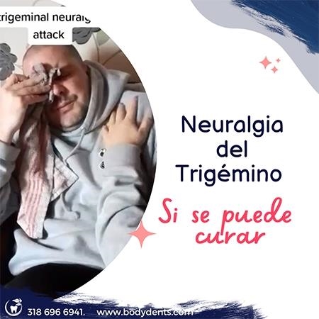 Neuralgia del trigémino