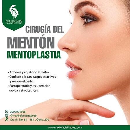 Chin Surgery - Mentoplasty