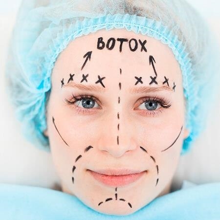 Botulinum toxin or Botox