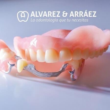 Complete removable prosthesis