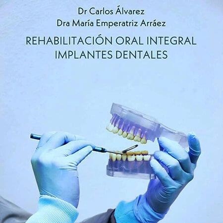 Cartagena dental implant