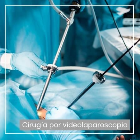 Cirugía por videolaparoscopia urológica