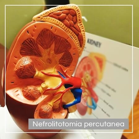 Percutaneous nephrolithotomy