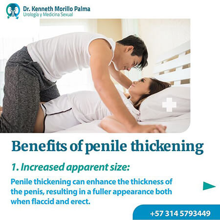 Penis thickening by lipoinjection