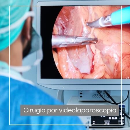 Videolaparoscopic surgery