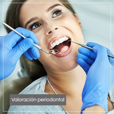 Valoración periodontal 