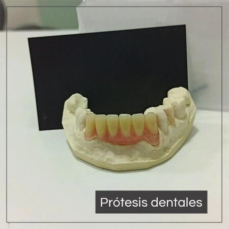 Prótesis dentales 