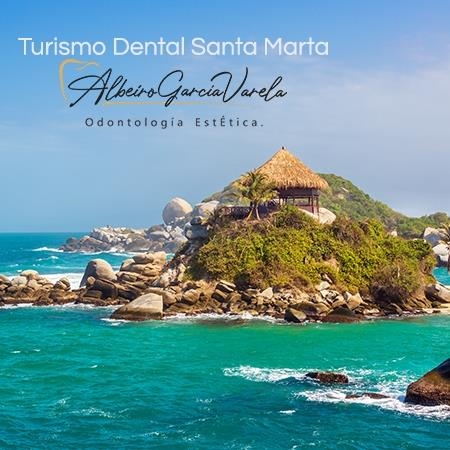 Turismo dental Santa Marta 