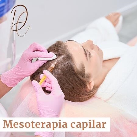 Mesoterapia capilar 