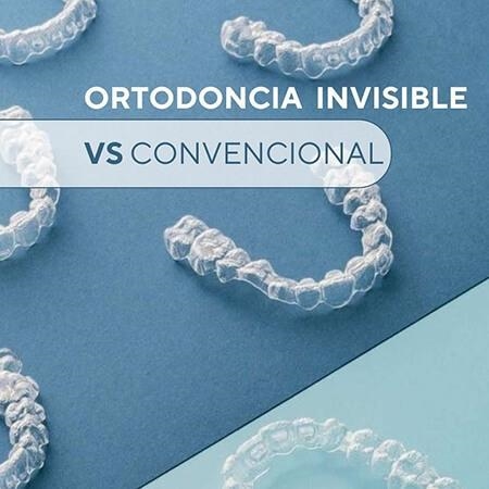 Ortodoncia invisible 