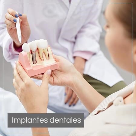 Implantes dentales 