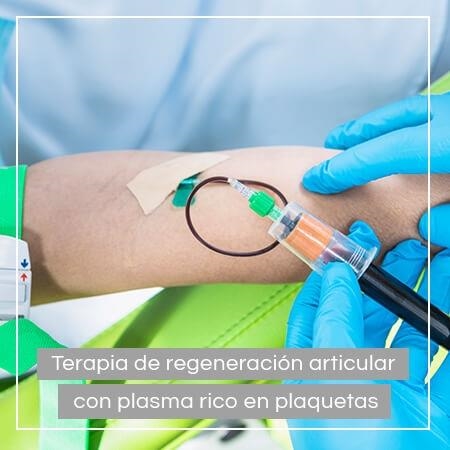Terapia de plasma rico en plaquetas o PRP