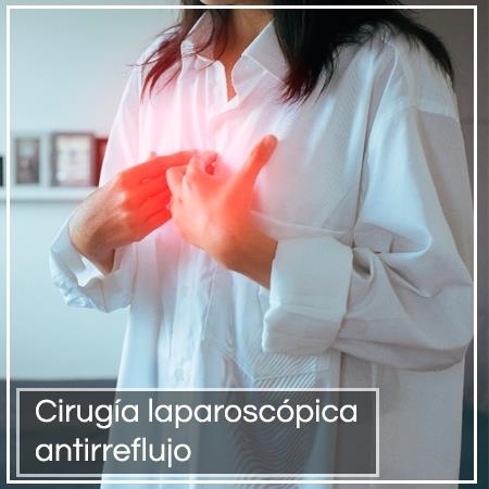 Cirugía laparoscópica antirreflujo 