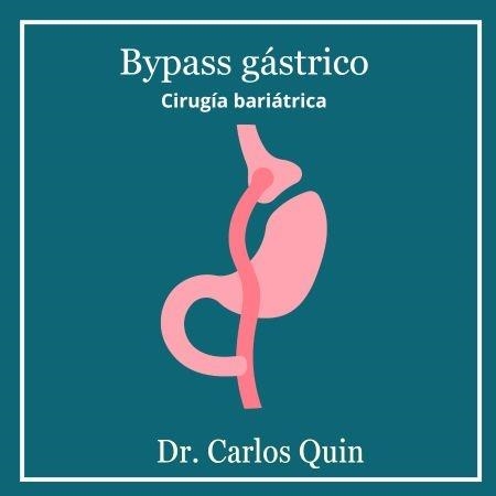 Gastric bypass