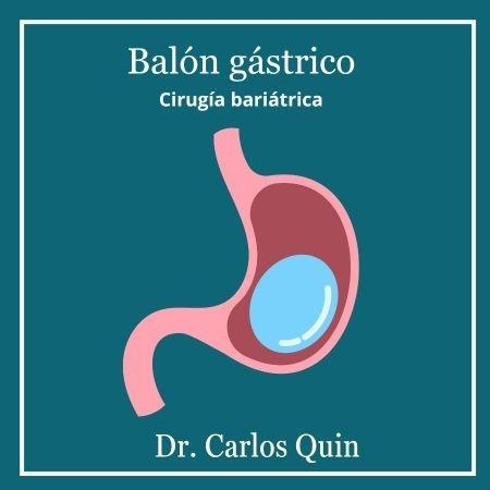 Gastric balloon