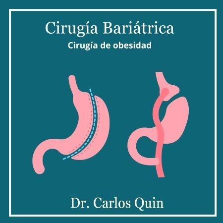 Bariatric surgery