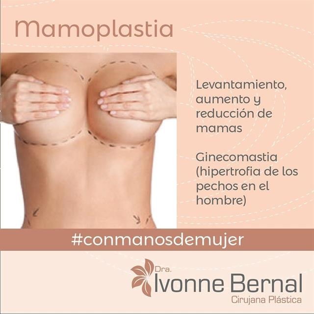 Mammoplasty