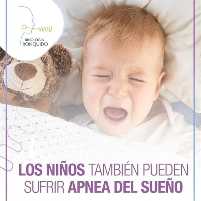 Snoring and apnea in children