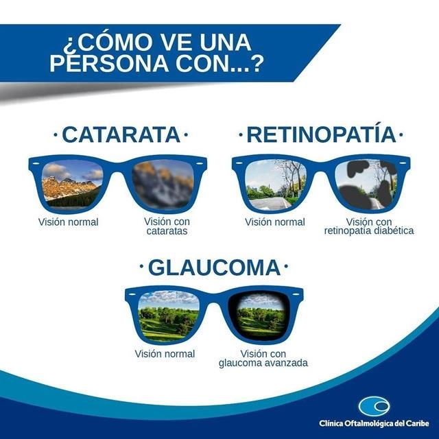 Catarata, retinopatia, glaucoma 