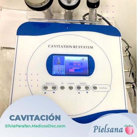 Cavitation and Radiofrequency